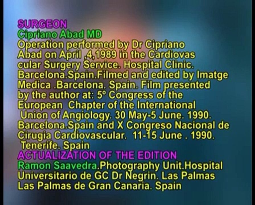 SPLENORENAL SHUNT
