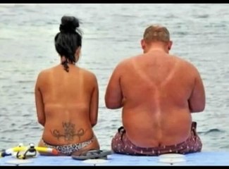 Quando l'abbronzatura diventa imbarazzante: la compilation definitiva dell'estate 2015