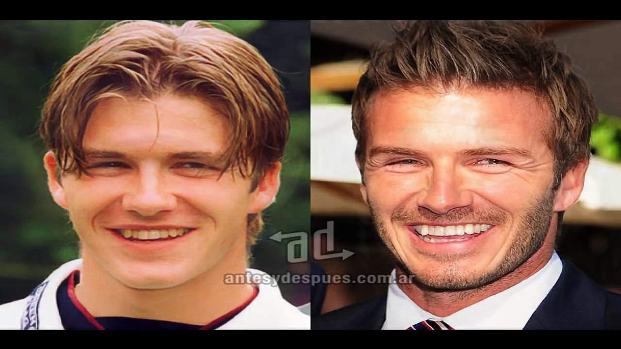 Dientes de famosos, el antes y el después!