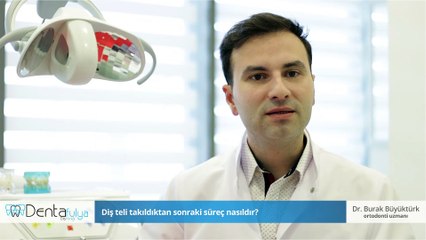 Diş teli takıldıktan sonraki süreç nasıldır? - Dr.Burak Büyüktürk