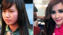 Nita Talia Sebelum dan Sesudah Operasi Plastik