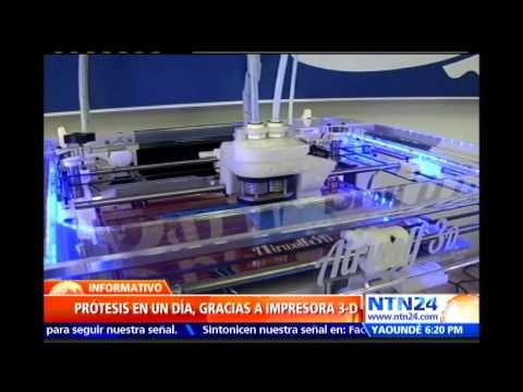 Diseñan prótesis personalizada para una niña en solo 24 horas gracias a una impresora 3D