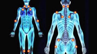 Fibromyalgia & Documentary Films