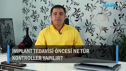 İmplant tedavisi öncesi ne tür kontroller yapılır