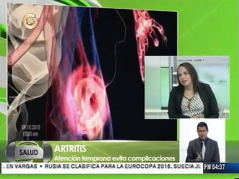 Rengel: Artritis reumatoide es una enfermedad común en jóvenes