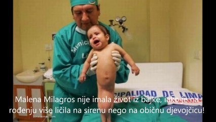 Djevojcica rodjena kao sirena