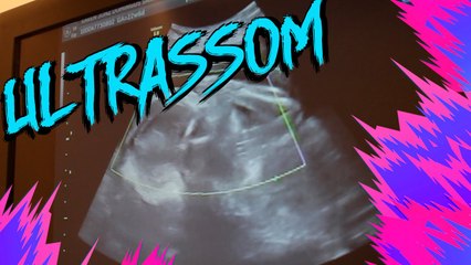 É MENINO OU MENINA??? | KAREN JONZ