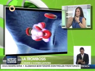 Mujeres son más propensas a sufrir de trombosis