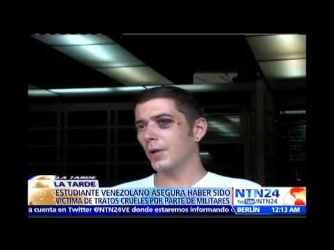 Estudiante venezolano relata brutal golpiza que recibió por parte de 15 efectivos de la GNB