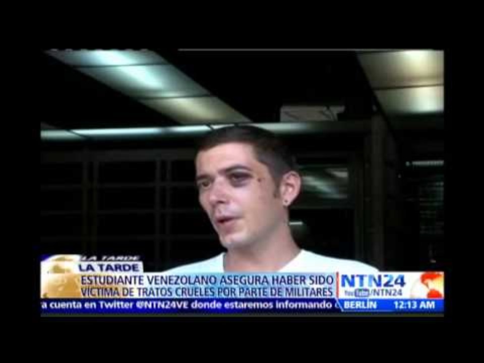 Estudiante venezolano relata  brutal golpiza que recibió por parte de 15 efectivos de la GNB