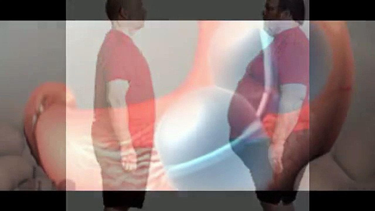 gastric stomach bariatric balloon