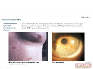 Neurology Pathology Part 3