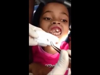 Sentiva solo un fastidio alle gengive, guardate il dentista cosa le tira fuori!