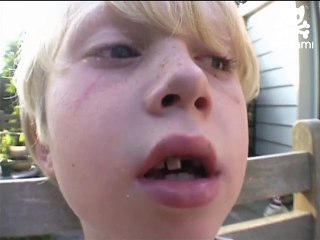 Dentist dog helps cure toothache