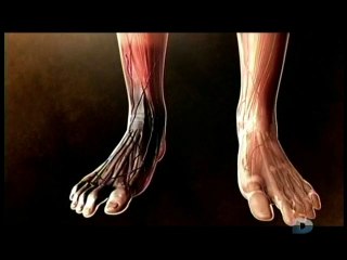 Morts insolites - E05