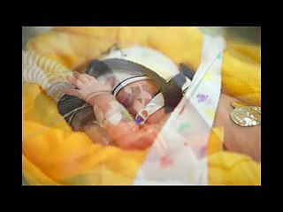 L'emozionante video del bambino dato ormai per spacciato che sopravvive