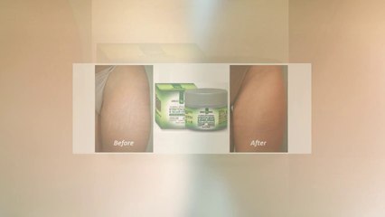 Stretch Mark & Scar Removal Cream - Markless