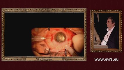 Retinal Detachment Problems_2