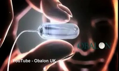 Would YOU swallow a mini gastric balloon to lose a stone