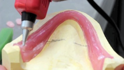 Jetwax Dental processus 06