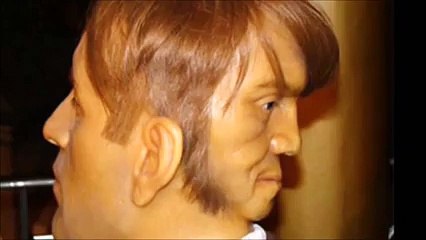 Edward Mordake - The man with two faces