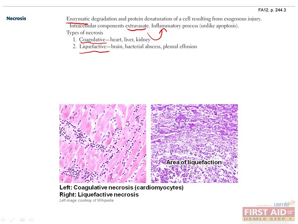Pathology Inflammation Part 1