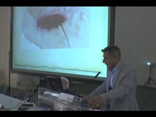 Napoli - Ortopedia, 15mila casi di amputazione all'anno per infezioni (16.10.15)