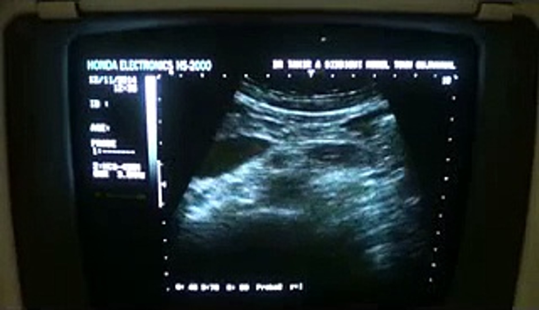 ⁣Renal Arteries From Start to Finish