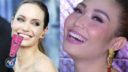 Serius, Ayu Dewi Pakai Behel Biar Tirus - Cumicam 18 Oktober 2015