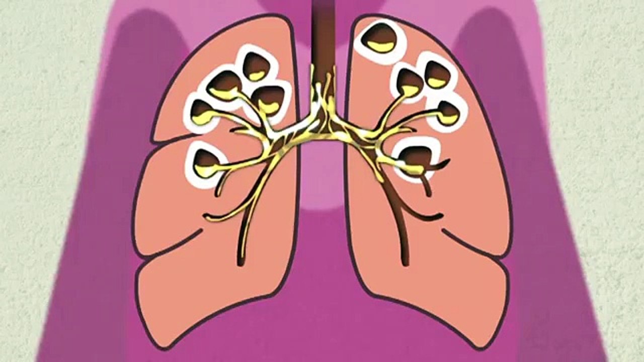 Bhalo Kof Nomuna, Sothik Chikitsha - (Bangla) Instructional video for sputum submission