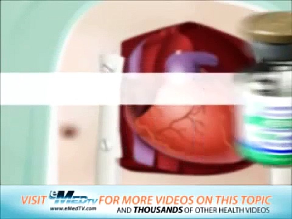 Mitral Valve