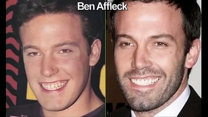 Le pouvoir des dents, Photos de 6 stars avant et après le changement..