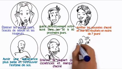 Comment Enlever Les Boutons