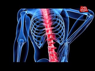 What is Osteoporosis?