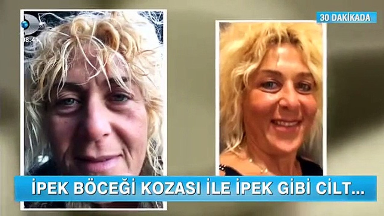 Esteworld İpek Koza Tekniği İrfan Değirmenci ile Kanal D Haber Günaydın'da!