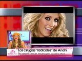 Las narices de las famosas: antes y después de la cirugía - Anahi, Belinda, Shakira y más...