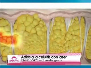 Pompis Perfectas con Laser