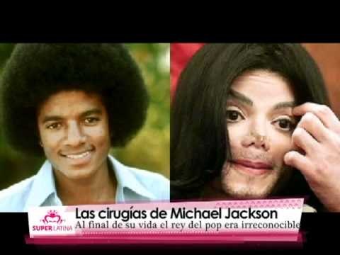 Famosos Adictos al Bisturí en SuperLatina: Quienes Quedaron Peor que Antes