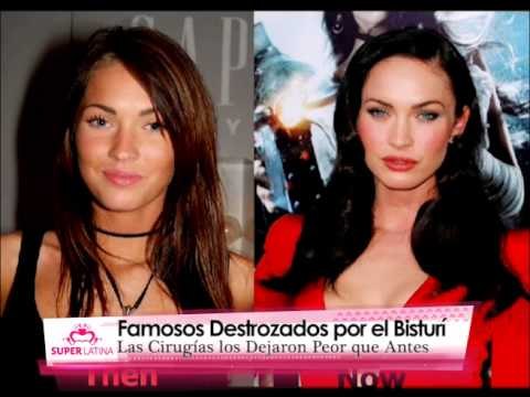 Bellas que destrozaron su rostro con cirugías - Gabriela Natale