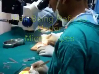 Microfollicular Graft Refining Under Microscopes at primus hospital