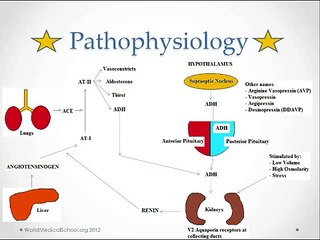 Diabetes Insipidus - USMLE Step 2 Review