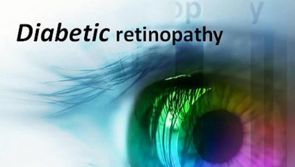 Guidelines of Diabetic Retinopathy by Opticare Optician