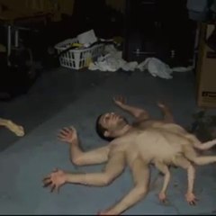 Young Man With 10 Hands Extra Body Parts It's a Real