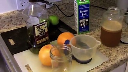 Natural Gallstone removal without surgery