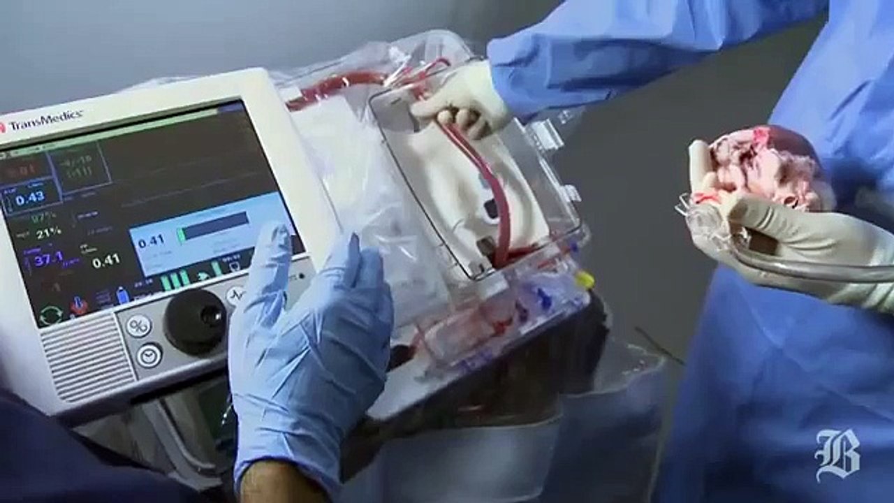 HEART BEATING,Donor's heart  blood circurlation