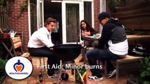 Minor Burn First Aid - Learn how to treat minor burns in less than 1 minute