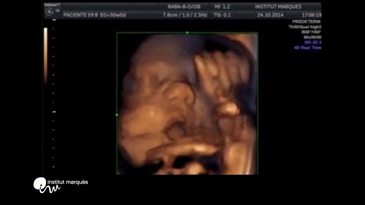 un bébé chante dans le ventre de sa mère quand il entend de la musique classique