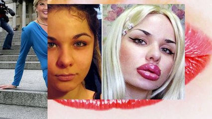 Extremely Big Body Parts On People