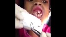 Le dentiste trouve 15 asticots dans la bouche de cet enfant