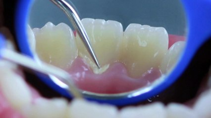 Des conseils pour une bonne santé buccodentaire